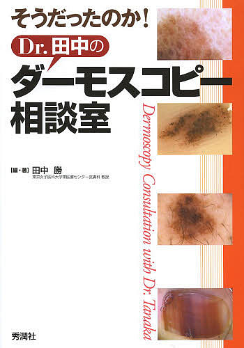 そうだったのか!Dr.田中のダーモスコピー相談室/田中勝