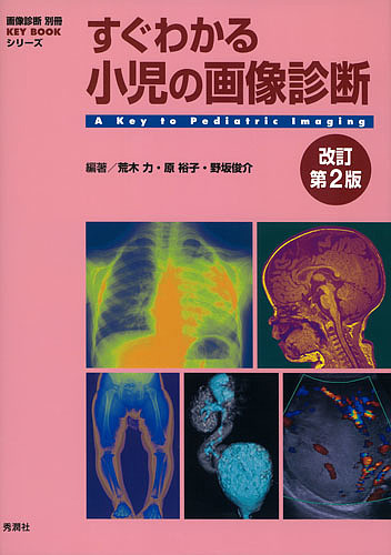 すぐわかる小児の画像診断/荒木力/原裕子/野坂俊介
