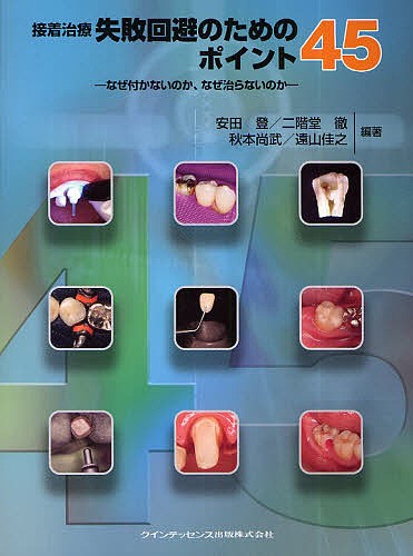 接着治療失敗回避のためのポイント45 なぜ付かないのか、なぜ