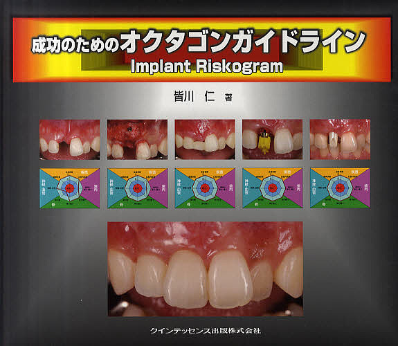 成功のためのオクタゴンガイドライン Implant Riskogram/皆川仁