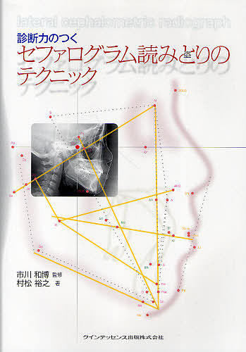 診断力のつくセファログラム読みとりのテクニック/市川和博/村松裕之