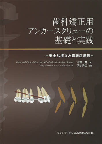 歯科矯正用アンカースクリューの基礎と実践 安全な植立と臨床応用例/本吉満/清水典佳