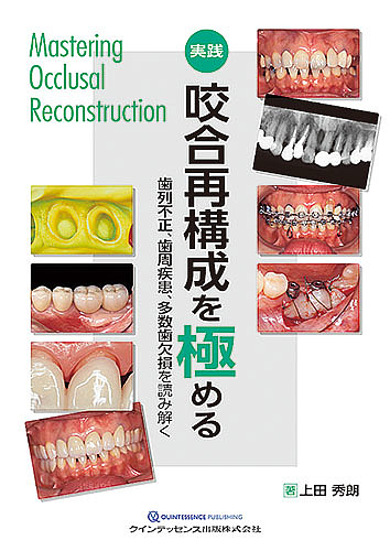 実践 咬合再構成を極める 歯列不正、歯周疾患、多数歯欠損を読み解く 実践 咬合再構成を極める: 歯列不正、歯周疾患、多数歯欠損を