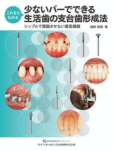 これならわかる少ないバーでできる生活歯の支台歯形成法 シンプルで露髄させない審美補綴/酒井邦明