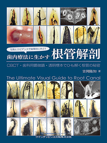 日本の民家 屋根の記憶—大橋富夫写真集(未使用 未開封の中古品)の通販