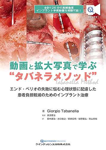 動画と拡大写真で学ぶ“タバネラメソッド” エンド・ペリオの失敗に悩む心理状態に配慮した患者負担軽減のためのインプラント治療