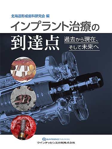 インプラント治療の到達点 過去から現在、そして未来へ/北海道形成歯科研究会