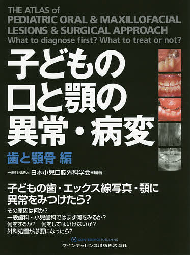 子どもの口と顎の異常・病変 歯と顎骨編/日本小児口腔外科学会