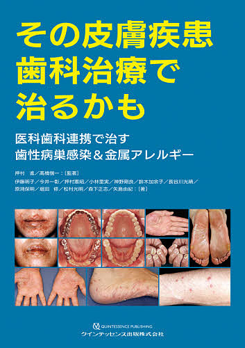 その皮膚疾患歯科治療で治るかも 医科歯科連携で治す歯性病巣感染&金属アレルギー/押村進/著高橋愼一/著伊藤明子