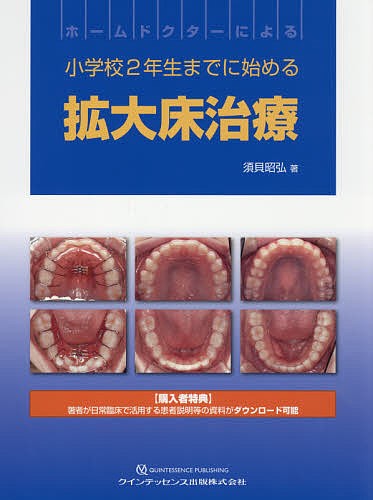 ホームドクターによる小学校2年生までに始める拡大床治療/須貝昭弘