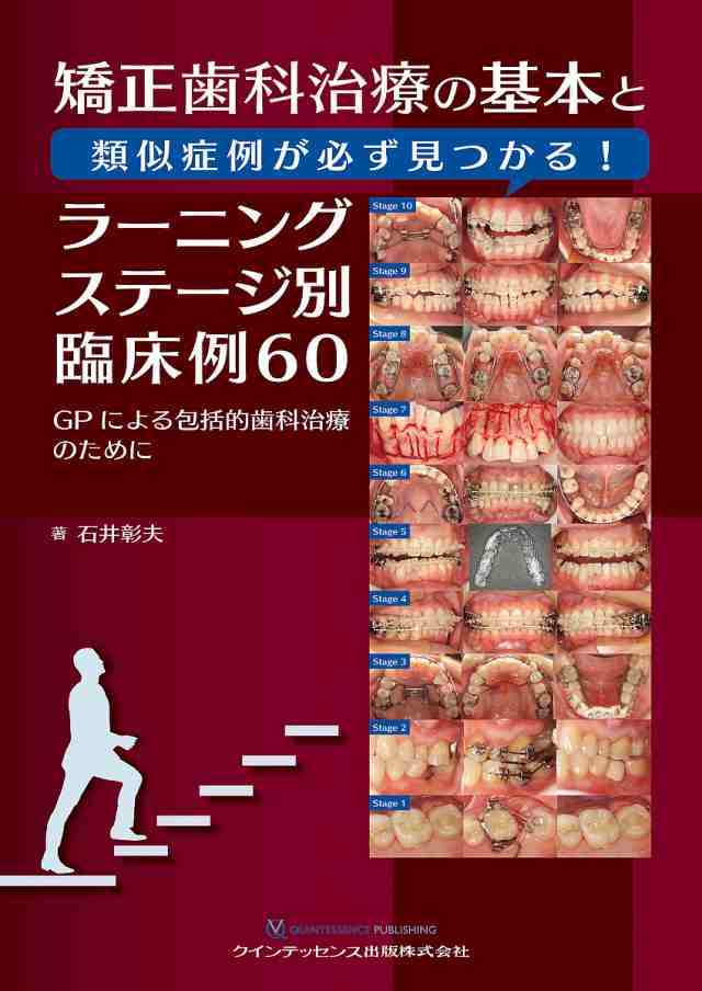 矯正歯科治療の基本と類似症例が必ず見つかる!ラーニングステージ別臨床例60 GPによる包括的歯科治療のために/石井彰夫