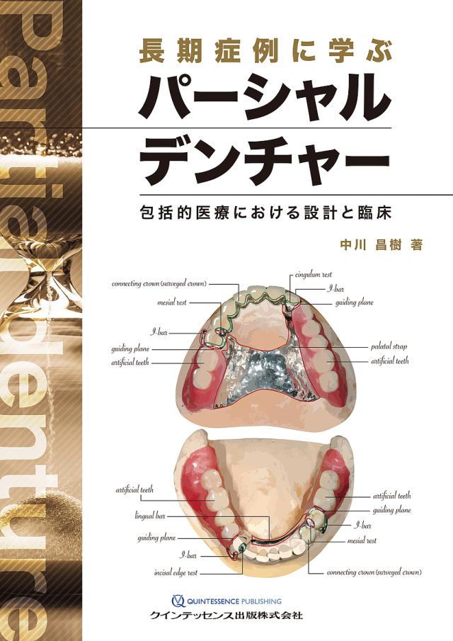 長期症例に学ぶパーシャルデンチャー 包括的医療における設計と臨床/中川昌樹