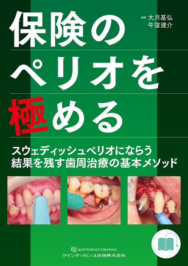 保険のペリオを極める スウェディッシュペリオにならう結果を残す歯周治療の基本メソッド/大月基弘/牛窪建介の通販は