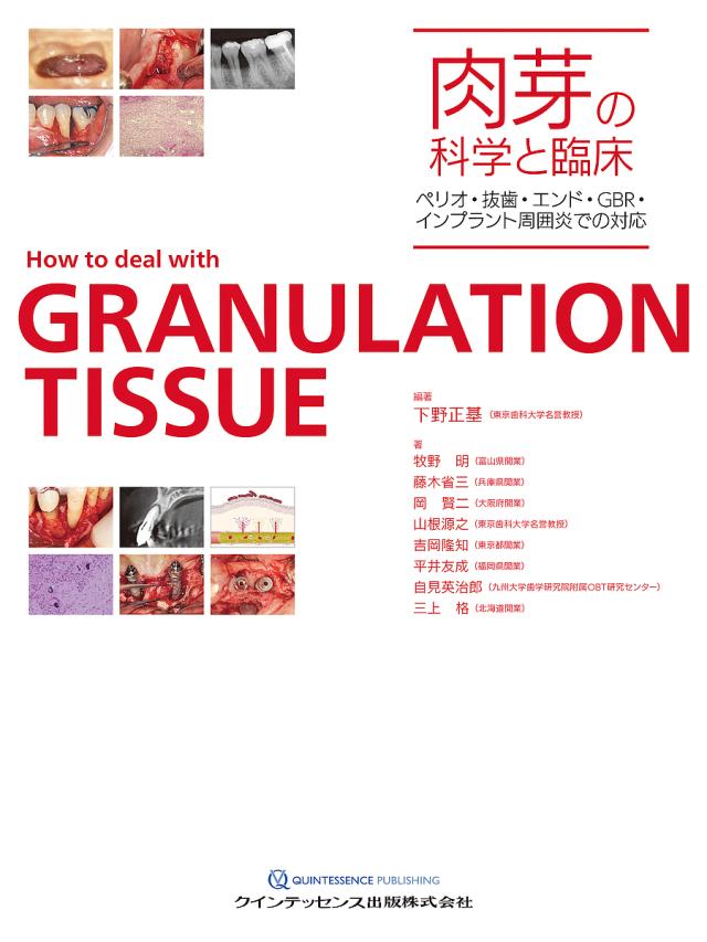 肉芽の科学と臨床 ペリオ・抜歯・エンド・GBR・インプラント周囲炎での対応/下野正基/牧野明/藤木省三