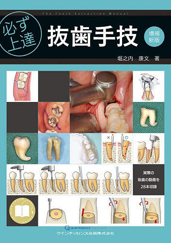 必ず上達抜歯手技/堀之内康文