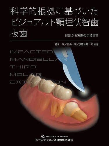 科学的根拠に基づいたビジュアル下顎埋伏智歯抜歯 診断から実際の手技まで/岩永譲/畠山一朗/伊原木聰一郎