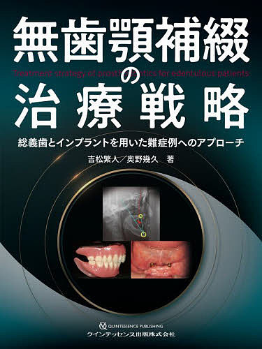 無歯顎補綴の治療戦略 総義歯とインプラントを用いた難症例へのアプローチ/吉松繁人/奥野幾久