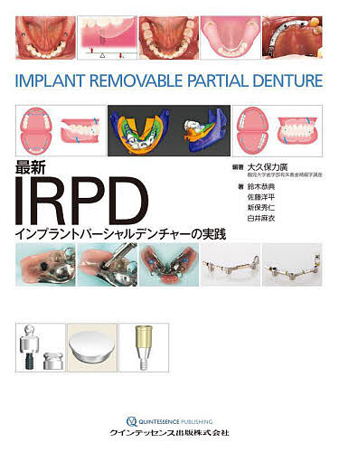 最新IRPDインプラントパーシャルデンチャーの実践/大久保力廣/鈴木恭典/佐藤洋平