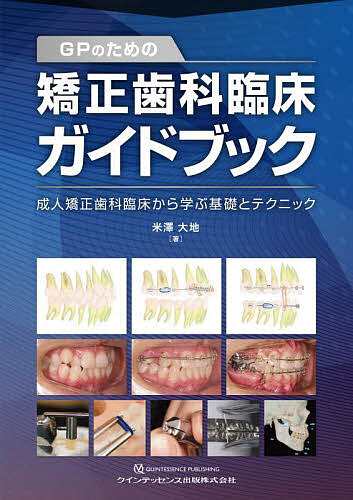 GPのための矯正歯科臨床ガイドブック 成人矯正歯科臨床から学ぶ基礎とテクニック/米澤大地