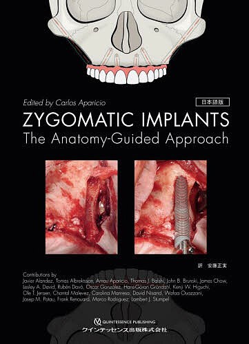 ZYGOMATIC IMPLANTS The Anatomy‐Guided Approach 日本語版/安藤正実