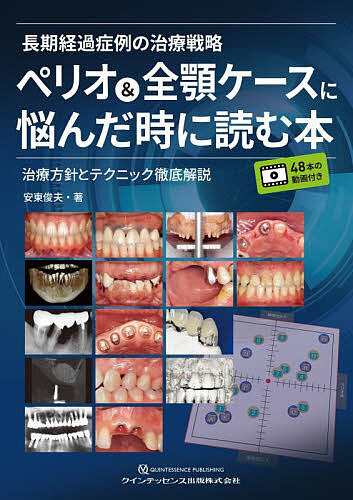 長期経過症例の治療戦略ペリオ&全顎ケースに悩んだ時に読む本 治療方針とテクニック徹底解説/安東俊夫