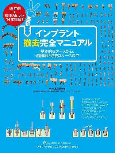 インプラント撤去完全マニュアル 基本的なケースから骨削除が必要なケースまで/佐々木匡理