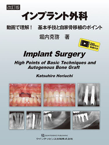 インプラント外科 動画で理解!基本手技と自家骨移植のポイント/堀内克啓