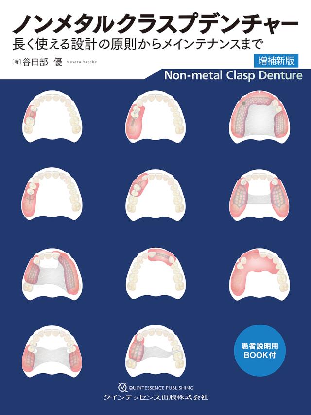 ノンメタルクラスプデンチャー 長く使える設計の原則からメインテナンスまで/谷田部優