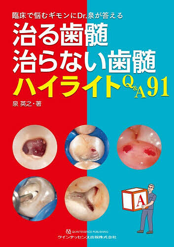 治る歯髄治らない歯髄ハイライトQ&amp;A91 臨床で悩むギモンにDr.泉が答える/泉英之
