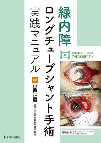 緑内障ロングチューブシャント手術実践マニュアル/谷戸正樹