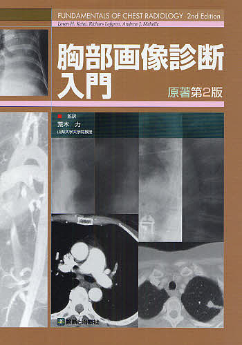 胸部画像診断入門/荒木力