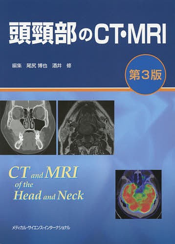 頭頸部のCT・MRI/尾尻博也/酒井修