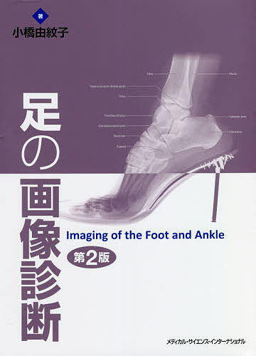 足の画像診断/小橋由紋子