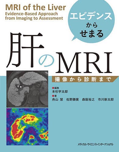 エビデンスからせまる肝のMRI 撮像から診断まで/本杉宇太郎/舟山慧/佐野勝廣