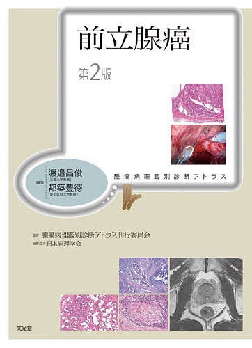 前立腺癌/渡邉昌俊/都築豊徳/腫瘍病理鑑別診断アトラス刊行委員会