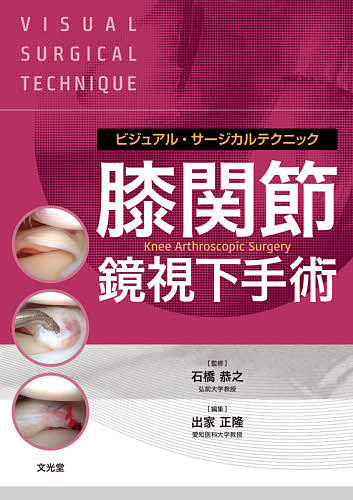 膝関節鏡視下手術/石橋恭之/出家正隆/鈴木大輔の通販は 10,439円