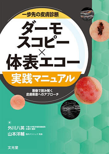 一歩先の皮膚診断ダーモスコピー×体表エコー実践マニュアル 画像で読み解く皮膚疾患へのアプローチ/外川八英/山本洋輔