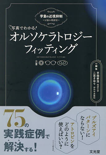 写真でわかる!オルソケラトロジーフィッティング 学童の近視抑制 お悩み相談室/平岡孝浩/二宮さゆり
