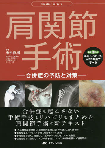 肩関節手術 合併症の予防と対策/末永直樹