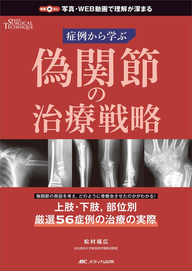 偽関節の治療戦略 症例から学ぶ/松村福広