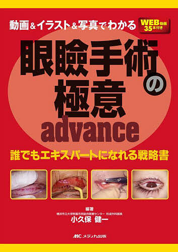 動画&amp;イラスト&amp;写真でわかる眼瞼手術の極意advance 誰でもエキスパートになれる戦略書/小久保健一