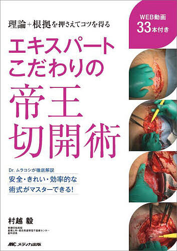 エキスパートこだわりの帝王切開術 理論+根拠を押さえてコツを得る/村越毅