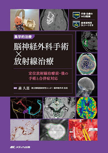 集学的治療脳神経外科手術×放射線治療 定位放射線治療前・後の手術と合併症対応/森久恵
