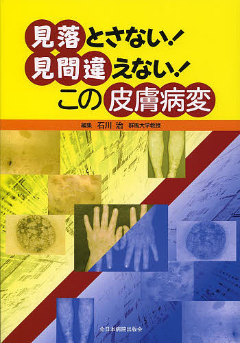 見落とさない!見間違えない!この皮膚病変/石川治