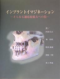 インプラントイマジネーション さらなる適応症拡大への技/山道信之