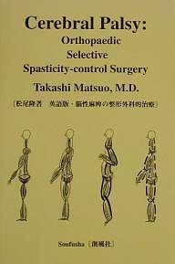 脳性麻痺の整形外科的治療 Cerebral palsy Orthopaedic selective spasticity‐con