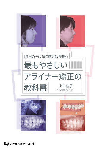 最もやさしいアライナー矯正の教科書