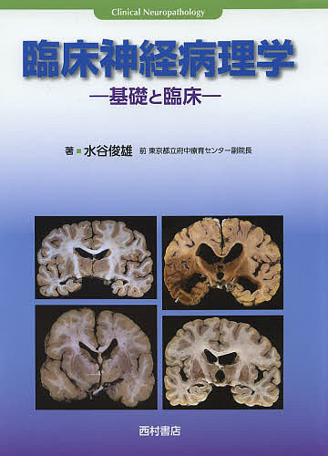 臨床神経病理学 基礎と臨床/水谷俊雄