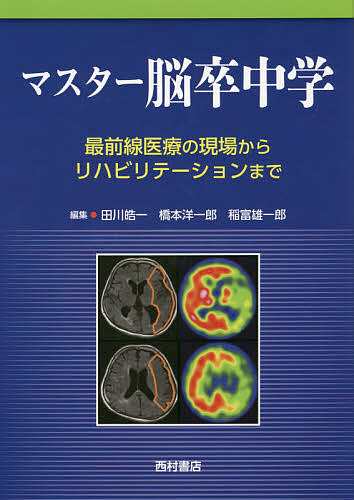 マスター脳卒中学 最前線医療の現場からリハビリテーションまで/田川皓一/橋本洋一郎/稲富雄一郎の通販は