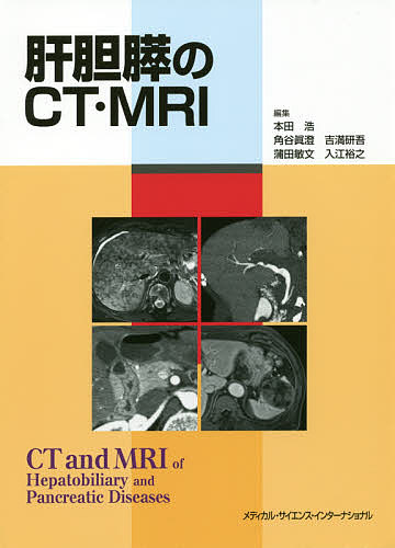 肝胆膵のCT・MRI/本田浩/角谷眞澄/吉満研吾